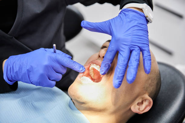Best Emergency Dental Care for Broken or Chipped Teeth in Early, TX
